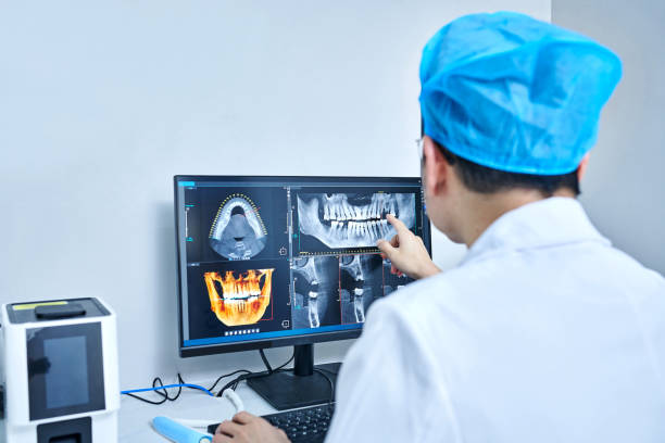 Best Emergency Wisdom Tooth Extraction in Bourbonnais, IL